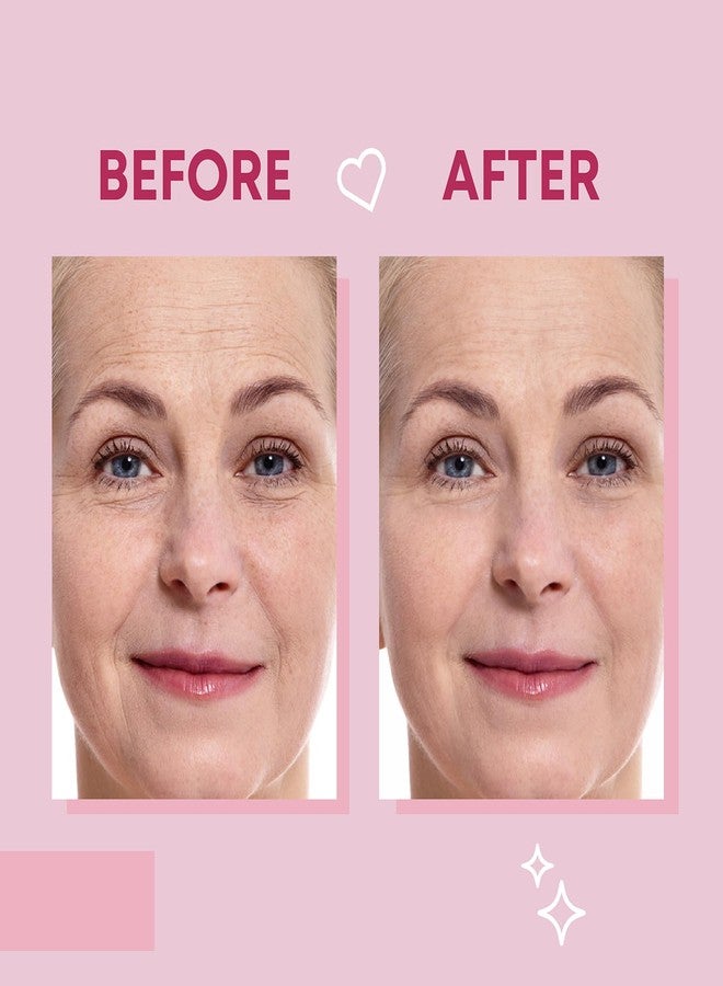 Bayside Forehead Wrinkle Patches and Smile Line Patches Set | Hyaluronic Acid Aloe Collagen Vitamin E | Overnight Treatment for Fine Lines Nasolabial Folds and Facial Wrinkles | Non-Invasive Skin-Friendly - Image 3
